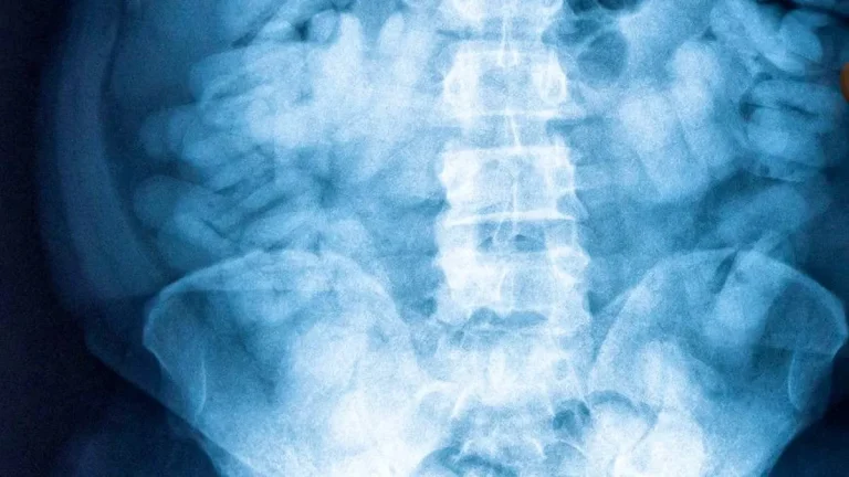 Surdose en vol : enquête révèle un trafic de drogue entre les États-Unis et Tahiti