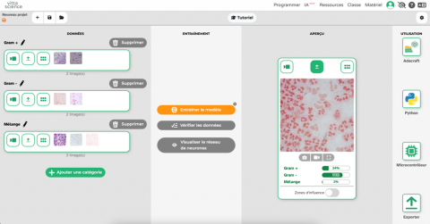 L’IA peut-elle être entraînée à la lecture d’une coloration de Gram ?