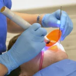 Lozère : Un ex-dentiste condamné à six ans de prison pour mutilations de patients