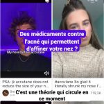 Des études révèlent que certains médicaments contre l&rsquo;acné peuvent affiner le nez.