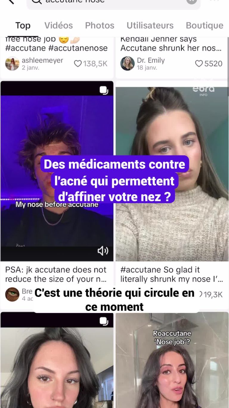 Des médicaments contre l&rsquo;acné pourraient modifier la forme du nez, selon des études cliniques.