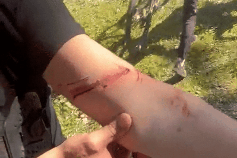 Adolescents blessés par un fil barbelé en VTT hors-piste en France, enquête en cours.