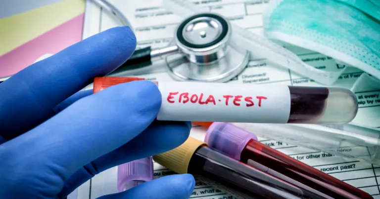 Ebola : les États-Unis renforcent les contrôles aux frontières pour prévenir l’épidémie
