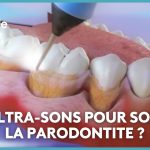 Parodontite et gingivite : recommandations de l'OMS pour le traitement des maladies des gencives