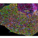 Démangeaisons et inflammation cutanée : les neurones impliqués, selon des chercheurs français.