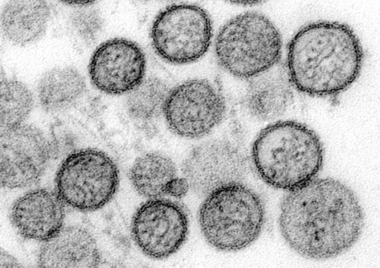 Hantavirus : Symptômes et modes de contamination, les recherches avancent en France.
