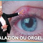 Traitements disponibles pour chalazion et orgelet : avis des professionnels de santé en France