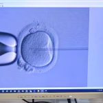 Des gynécologues néerlandais impliqués dans des PMA frauduleuses avec leur propre sperme
