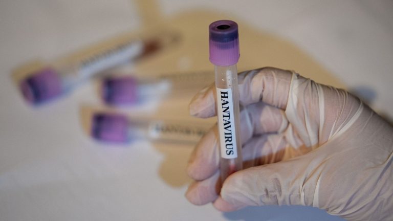 L’hantavirus détecté dans plusieurs régions, inquiétude croissante après le Covid-19.