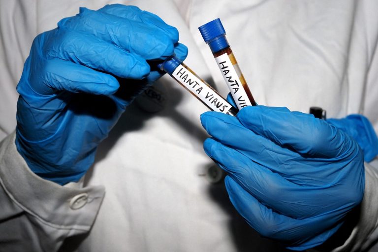 Hantavirus à Paris : trois personnes contaminées par une souche identifiée.