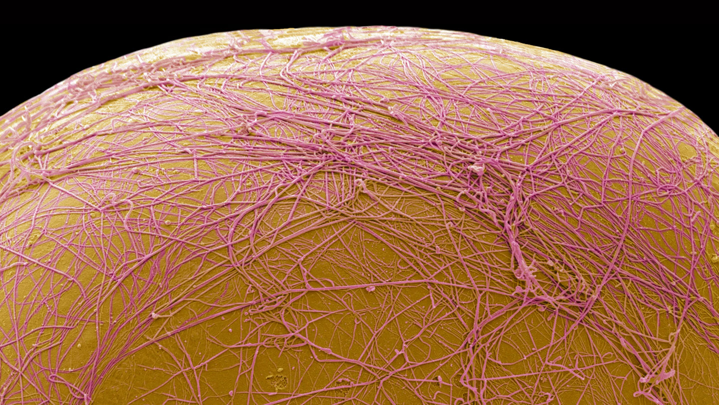 Dans de petits essais, le CBL-514 réduit la graisse viscérale abdominale chez les participants injectés