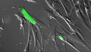 Élimination des cellules sénescentes : un nouveau mécanisme à l&rsquo;étude pour lutter contre le vieillissement.