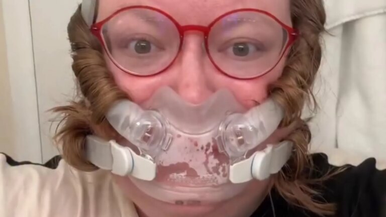 Ashley Noll utilise sa CPAP contre l’apnée du sommeil pour boucler ses cheveux sans chaleur