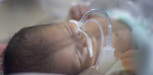 Dépistage des cardiopathies congénitales : une nouvelle technique non invasive prometteuse pour les enfants